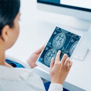 Neuroriabilitazione e Aging Brain